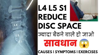 L4L5 and L5S1 reduced disc space exercises in Hindi  Disc space narrowing L5S1 treatment [upl. by Suired]