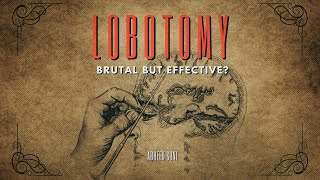 Lobotomy A Brutal but Effective Treatment The Dark side of Science [upl. by Wilhelmine]