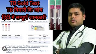 Quantiferon TB Gold test in Hindi  टीबी मरीजों के लिए TB gold टेस्ट क्या है  Result amp Normal value [upl. by Rozella435]