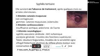 maladies sexuellement transmissibles Dr SERRADJ [upl. by Anauqahs]