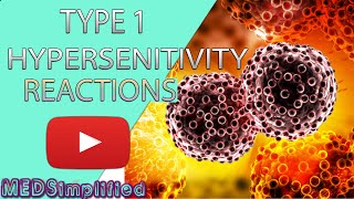 Hypersensitivity Type 1 Reactions Made Easy Type 1 Allergic Reaction [upl. by Nibuz]