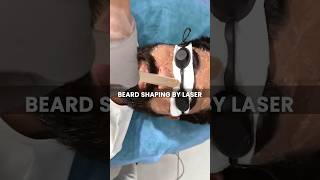 Permanent Laser Beard Shaping Treatment Skinaa Clinic viral shorts [upl. by Kartis]