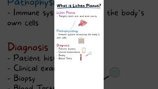 ORAL LICHEN PLANUS EXPLAINED [upl. by Suckow]