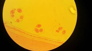 Echinococcus granulsus hydatid cyst wall [upl. by Alston703]