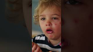 Whooping Cough What You Need to Know [upl. by Ilysa]