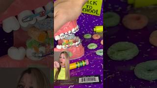 WORST HABITS FOR BRACES 🫣 Bad Habits for your Teeth 🦷 Orthodontist Reacts Crunchy RAMEN Food ASMR [upl. by Adrial166]