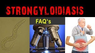 What is Strongyloidiasis   FAQ and answers [upl. by Mesics426]