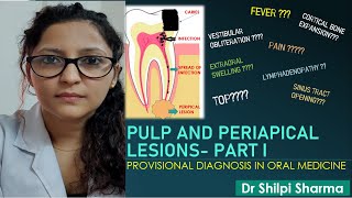 Pulp and periapical lesions  Part I in Hindi। Chairside Diagnosis [upl. by Ostler359]