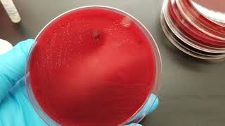 Microbiology Oxidase Test [upl. by Casta]