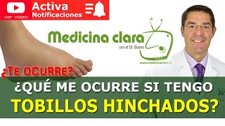 TOBILLOS HINCHADOS Dolor en los Tobillos Causas y soluciones  Medicina Clara [upl. by Seerdi404]