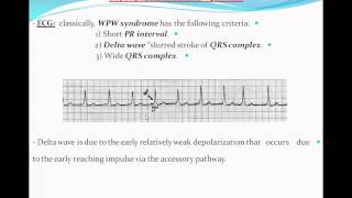 Principles of ECG quotelectrocardiographyquot Part 9 [upl. by Enileqcaj216]