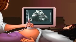 How Ultrasound Works Animation  Ultrasound Scan During Pregnancy Video  USG Medical Imaging [upl. by Allegna]