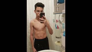 Pectus Carinatum Bodybuilding Transformation 2 Year Body Metamorphosis [upl. by Sykes]