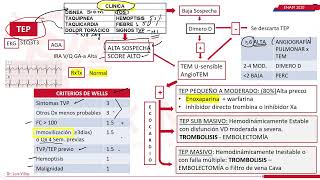 Trombo embolismo Pulmonar  ENAM [upl. by Wheelwright166]