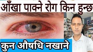 Conjunctivitis in Nepali आँखा किन पाक्ने गर्छ। यस्तो बेलामा कुन कुन औषधि आँखामा राख्नु हुँदैन। [upl. by Ydor]