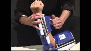 Wearing the Neurological Elbow Extension Dynasplint® [upl. by Ahsiekal]