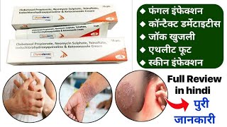 Tynoderm cream full review in Hindi  fivederm cream review in hindi  dermi 5 cream in hindi [upl. by Nyrrat258]