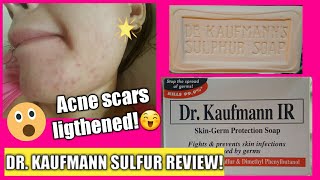 DR KAUFMANN SULFUR SOAP REVIEW  JHEZEL G [upl. by Retrak]