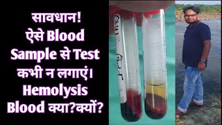 Hemolysis Blood क्या हैक्यों होता है  Hemolyzed Blood से Test क्यों नही लगाए [upl. by Eppesiug]