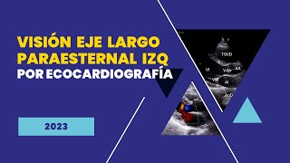 🔎vision 🔀EJE LARGO PARAESTERNAL IZQUIERDO por ecocardiografía [upl. by Asabi]