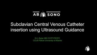 Ultrasoundguided subclavian venous access [upl. by Valerye978]