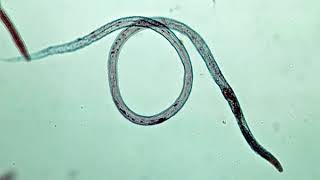 Study of Life Stages of Meloidogyne Rotylenchulus and Radopholus [upl. by Bertha]