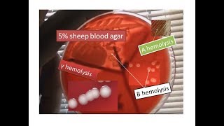 Blood agar showing alpha beta and gamma hemolysis  Use of blood agar [upl. by Saidnac]