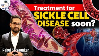 US FDA to approve genetic editing treatment for SICKLE cell  Rahul Saigaonkar StudyIQ IAS English [upl. by Htebazle]