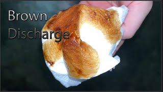 What Is Brown Discharge Before Periods [upl. by Baer28]