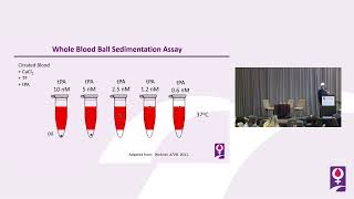 Why Is It So Hard to Measure Fibrinolysis  Nigel Key MB ChB FRCP [upl. by Treat609]