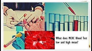 MCHC Blood Test  Low Normal High [upl. by Nuahsad251]