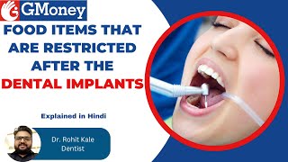 Benefits amp Risks of Dental Implants  GMoney Health Show [upl. by Larual]