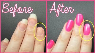 FIX A BROKEN NAIL FAST [upl. by Beverly501]