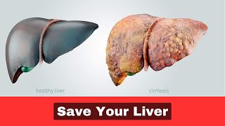 Avoid These Liver Damaging Supplements [upl. by Brodeur]