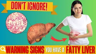 LIVER is DYING  8 Early Warning Signs That Indicate Fatty Liver Disease  YOU CANT IGNORE [upl. by Season385]