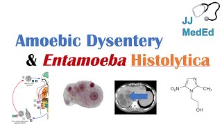 Amebiasis Amoebic Dysentery  Entamoeba histolytica Pathogenesis Signs amp Symptoms Treatment [upl. by Kooima]