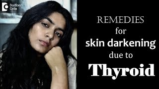 Can thyroid problems cause skin discoloration Causes amp Treatment  Dr Rasya Dixit [upl. by Frankie]