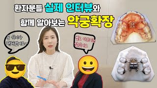 악궁확장장치 모든 것 그리고 숨겨진 효과 평수가 넓어지니 숨쉬기가 편해졌어요 비염 개선 실화 [upl. by Drofdeb]