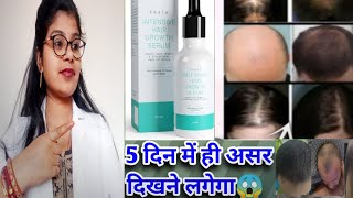 Aratas Intensive Hair Growth Serum Powered by Turmeric  Intensive Hair Serum honest review 2024 [upl. by Adanar]