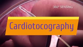 Cardiotocography Trailer [upl. by Anaidiriv]