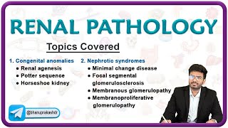 🌟 Exploring Renal Pathology Congenital Anomalies amp Nephrotic Syndromes 🌊 [upl. by Barbara621]