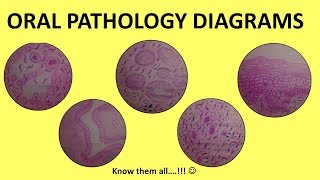 Oral Pathology Diagrams  BDS Third Year  Histopathology [upl. by Farand]