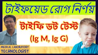 Typhi Dot Test IgM IgG for Typhoid Fever  টাইফয়েড রোগ নির্ণয় টাইফি ডট টেস্ট IgM IgG [upl. by Ahsirtal]