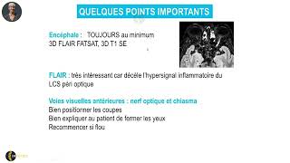 Extrait du cours sur la névrite optique par le Dr Françoise Héran [upl. by Peters]