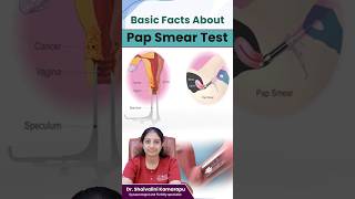 Importance Of Pap Smear Test  The Vital Role of Pap Smear Tests in Cervical Health  shorts [upl. by Rothwell]