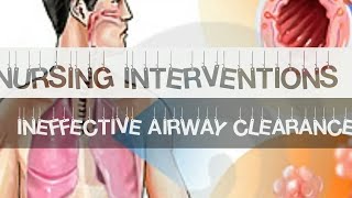 Nursing Interventions with rationale  Ineffective airway clearance [upl. by Bethesda]