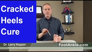 How to Treat Dry Cracked Heels with Seattle Foot Doctor Larry Huppin [upl. by Jon673]