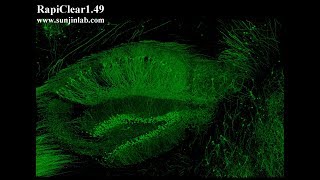 Mouse Hippocampus in 3D [upl. by Enilrad734]