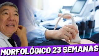 MORFOLÓGICO DE 23 SEMANAS [upl. by Tremann]