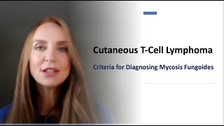 Criteria to Diagnose Mycosis Fungoides Chapter 1 [upl. by Anilorak949]